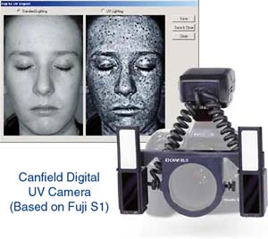 Digital UV kit