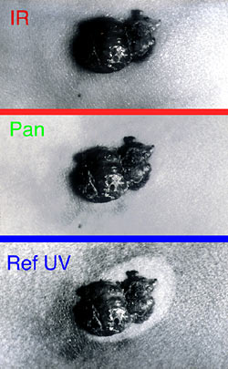 Changes in skin pigments under UV radiation