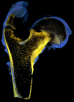 UV fluorescence in Perthes' disease